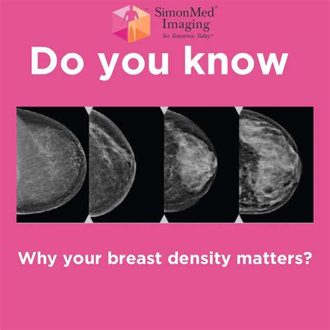 the villages breast imaging|SimonMed Imaging .
